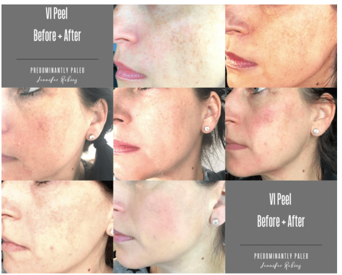 skin care ads