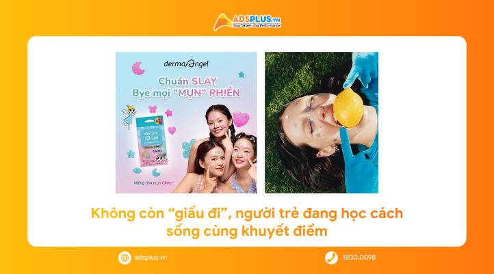 Từ &ldquo;che&rdquo; đến &ldquo;trang tr&iacute;&rdquo;: Khi Gen Z thay đổi c&aacute;ch nh&igrave;n về khuyết điểm